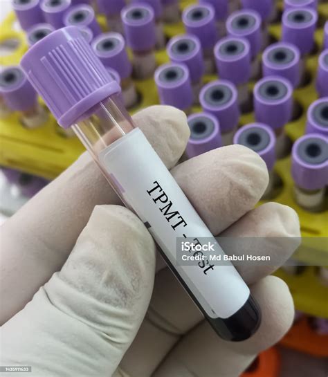 6 tgn blood test bottle|6 tgn thiopurine.